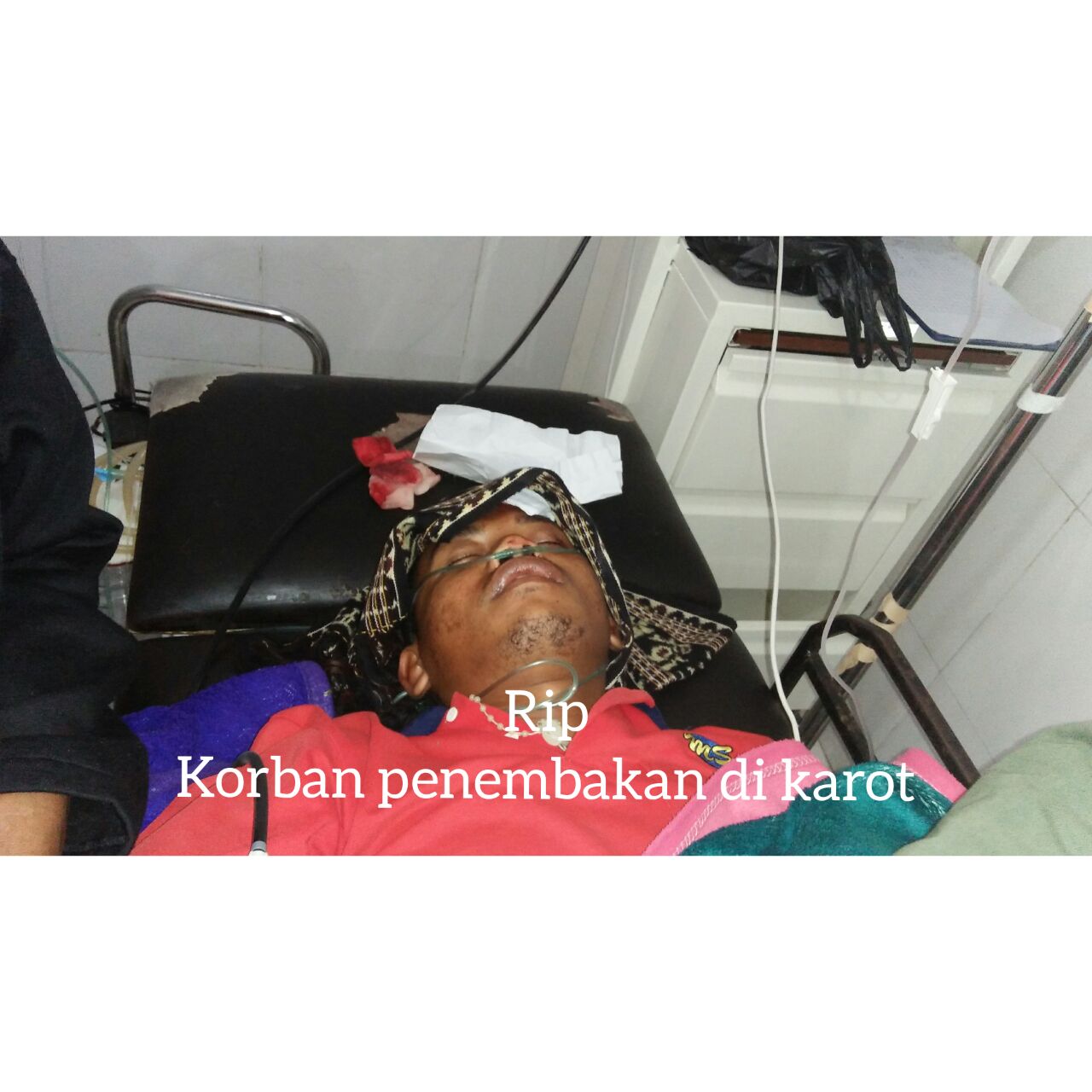 Meninggalnya Ferdinandus Tarus Bukti Buruknya Pelayanan Publik Di Manggarai