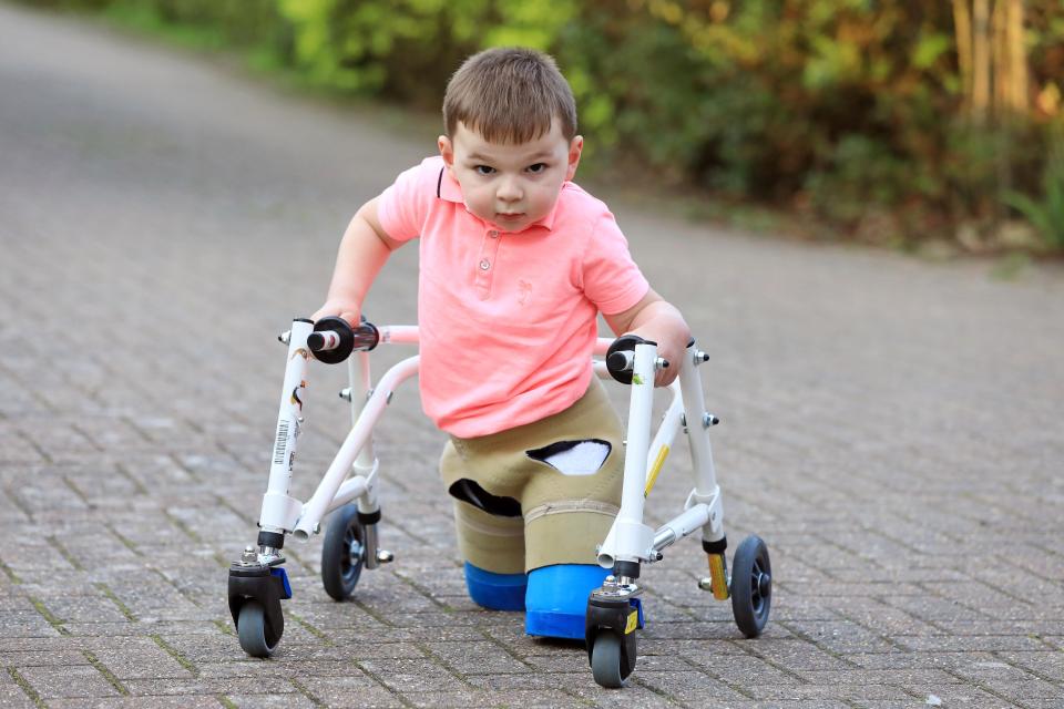 Disiksa Orangtuanya, Kini Bocah Ini Bangkit Walau Alami Kelumpuhan