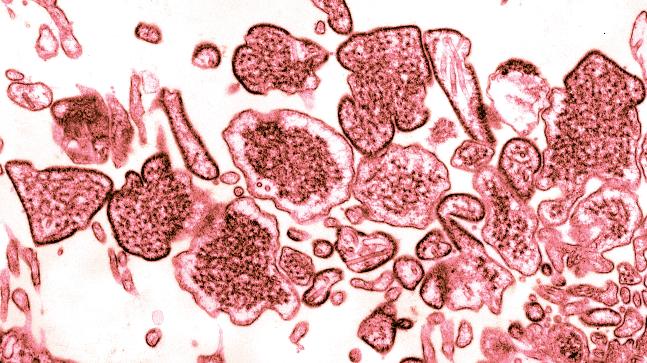 Nipah, Virus Mematikan Tanpa Obat Ancaman Bagi Dunia