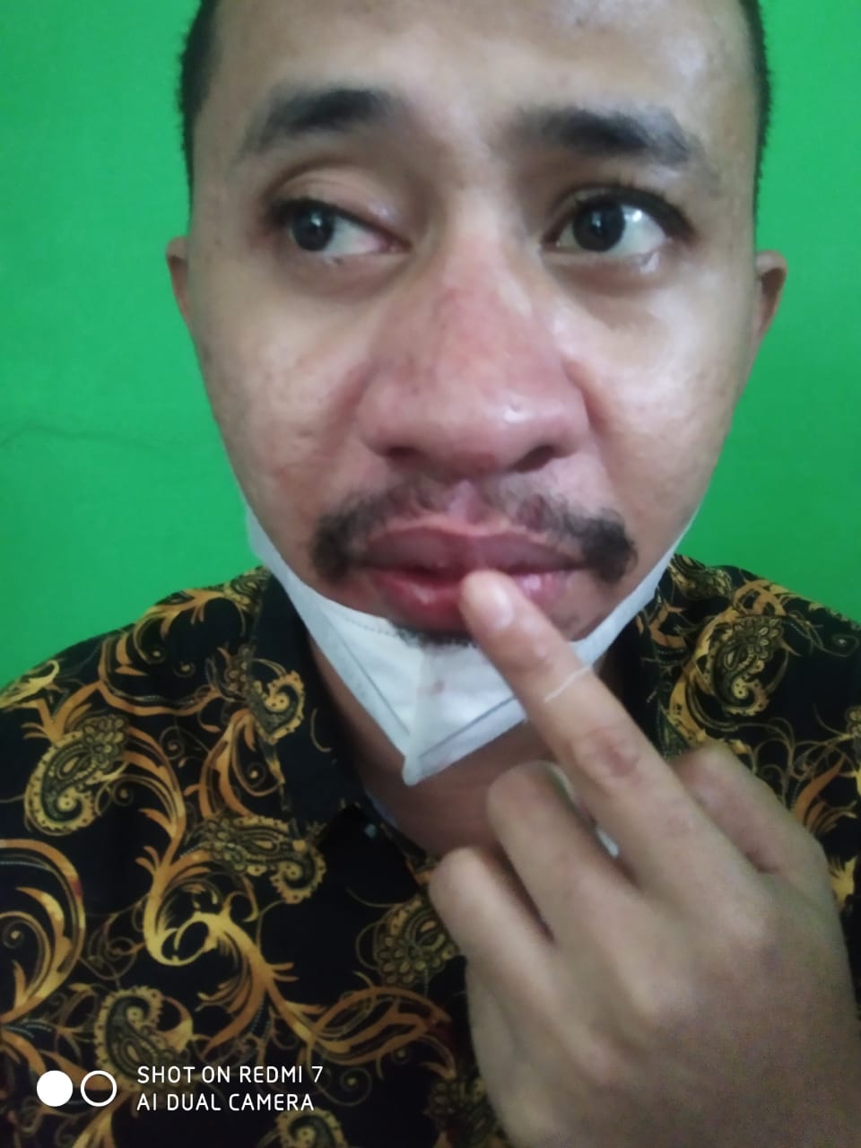 Di NTT, Seorang Dokter Dihajar Oknum Anggota TNI Hingga Pendarahan di Hidung