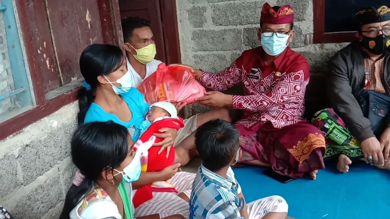 Dinsos Buleleng Sambangi Rumah Bayi Kelainan Kelamin