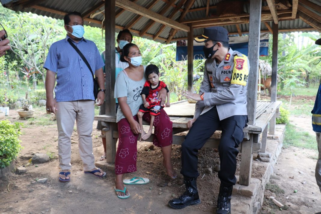 Bantuan Sosial Kapolres Pada Anak Lumpuh di Buleleng
