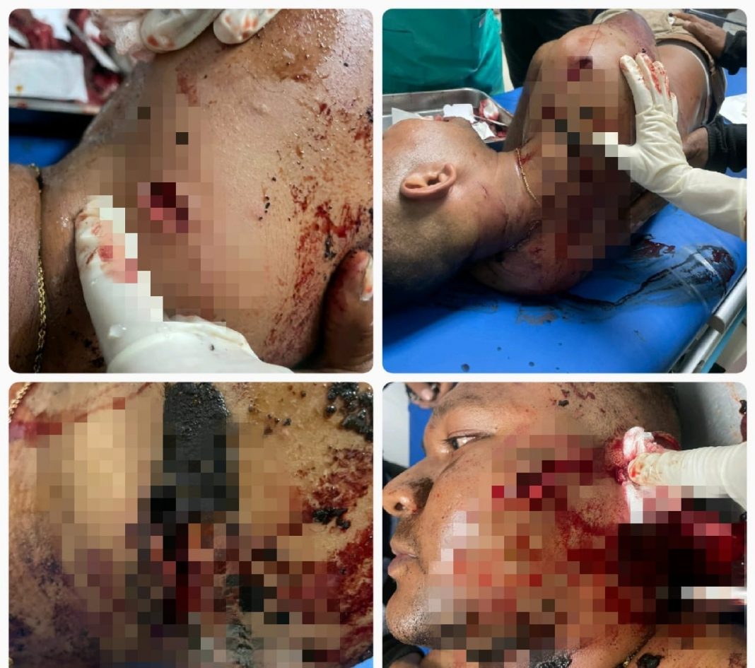 Oknum Brimob Atambua Tikam Seorang Warga Perbatasan RI-RDTL Secara “Membabi Buta” Hingga Sekarat