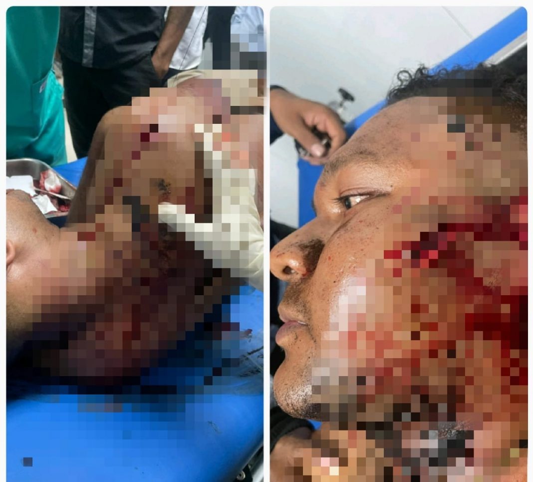 Kapolri Diminta Terapkan Hukum Darurat Untuk Anggota Brimob Atambua Yang Menikam Warga Sipil. Ini Alasannya!