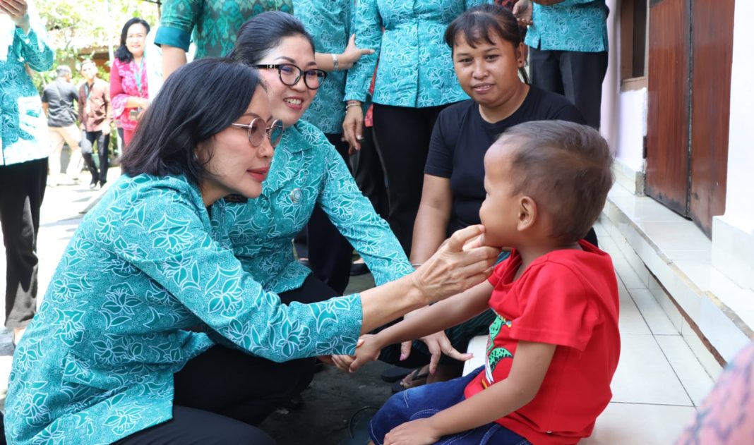 Cek Gigi Balita Secara Langsung, Ny. drg. Ida Mahendra Jaya Ingatkan Orangtua Larang Anak Konsumsi Makanan Mengandung Gula Berlebihan